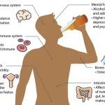 Dampak Konsumsi Alkohol Berlebihan Kesehatan Jangka Panjang