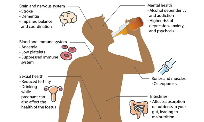 Dampak Konsumsi Alkohol Berlebihan Kesehatan Jangka Panjang